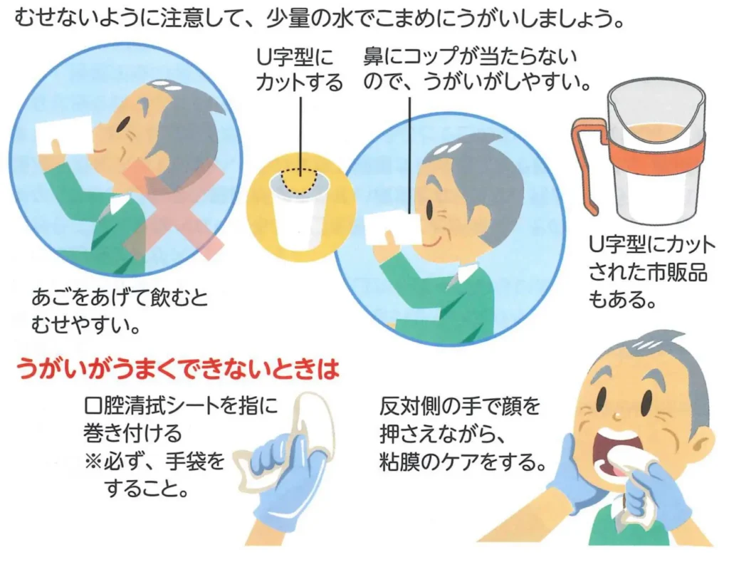 ขั้นตอนการทำ Mouth Care จะแตกต่างกันไป ขึ้นอยู่กับการรับรู้และความเข้าใจของผู้ป่วย โดยหลัก ๆ จะแบ่ง 2 กลุ่ม ได้แก่ ผู้ป่วยติดเตียง (ไม่สามารถช่วยเหลือตัวเองได้) หรือมีปัญหาด้านความคิดและความเข้าใจ และผู้ป่วยที่มี TT tube